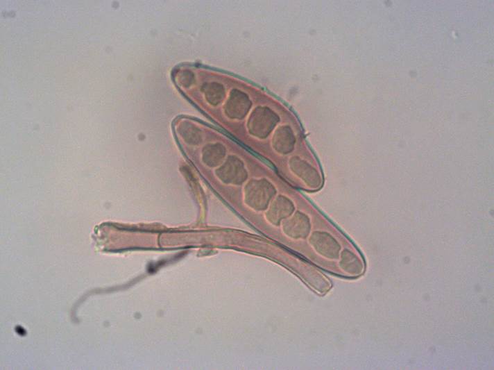 morfologi helminthosporium oryzae)